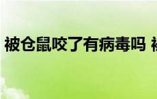 被仓鼠咬了有病毒吗 被仓鼠咬了有潜伏期吗 