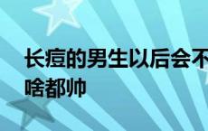 长痘的男生以后会不会变帅 长痘痘的男生为啥都帅 