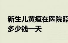 新生儿黄疸在医院照蓝光多少钱一天 照蓝光多少钱一天 