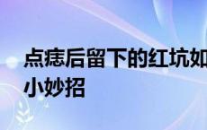 点痣后留下的红坑如何消除 去点痣后红印坑小妙招 