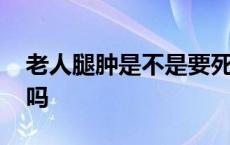 老人腿肿是不是要死了 老人腿肿要死的征兆吗 