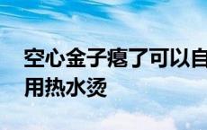 空心金子瘪了可以自己修复吗 空心金子瘪了用热水烫 