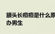 额头长痘痘是什么原因男生 额头长痘痘怎么办男生 