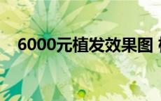 6000元植发效果图 植发际线是永久的吗 