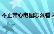 不正常心电图怎么看 不正常的心电图报告单 