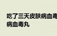 吃了三天皮肤病血毒丸还没好 吃了三天皮肤病血毒丸 