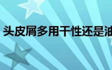 头皮屑多用干性还是油性洗发水 油性洗发水 