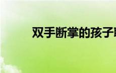 双手断掌的孩子聪明吗 双手断掌 