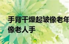 手背干燥起皱像老年皮肤一样 手背干燥粗糙像老人手 