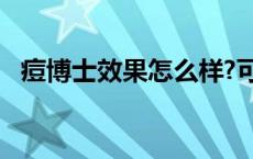 痘博士效果怎么样?可信吗 痘博士效果怎么样 