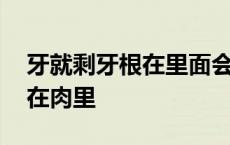 牙就剩牙根在里面会怎么样 牙齿只剩下残根在肉里 