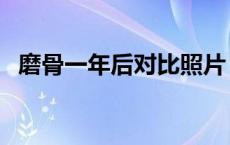 磨骨一年后对比照片 教你揉颧骨改变脸型 