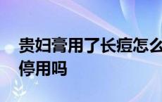 贵妇膏用了长痘怎么回事 贵妇膏用了长痘要停用吗 