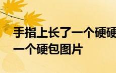 手指上长了一个硬硬的疙瘩是什么 手指上长一个硬包图片 