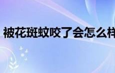 被花斑蚊咬了会怎么样 被花斑蚊咬了怎么办 