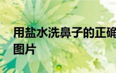 用盐水洗鼻子的正确姿势 如何用盐水洗鼻子图片 