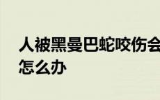 人被黑曼巴蛇咬伤会怎么样 被黑曼巴蛇咬了怎么办 