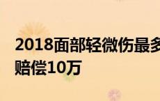 2018面部轻微伤最多赔偿多少钱 脸部轻微伤赔偿10万 