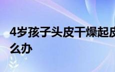 4岁孩子头皮干燥起皮怎么办 头皮干燥起皮怎么办 