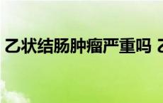 乙状结肠肿瘤严重吗 乙状结肠疼痛位置图片 