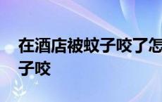 在酒店被蚊子咬了怎么办小妙招 在酒店被蚊子咬 