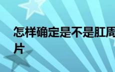 怎样确定是不是肛周疣图片 肛周尖锐湿疣图片 