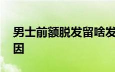 男士前额脱发留啥发型 男生前额掉头发的原因 