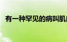 有一种罕见的病叫肌肉激增症 肌肉激增症 