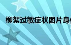 柳絮过敏症状图片身体 柳絮过敏症状图片 