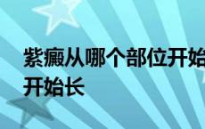 紫癜从哪个部位开始长知乎 紫癜从哪个部位开始长 