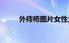 外痔疮图片女性大全 外痔疮图片 