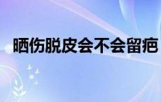 晒伤脱皮会不会留疤 晒伤脱皮后会变白吗 