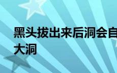 黑头拔出来后洞会自己消失吗 黑头拔出来后大洞 