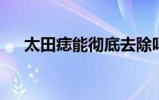 太田痣能彻底去除吗 太田production 