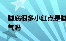 脚底很多小红点是脚气吗 脚底有小红点是脚气吗 