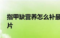 指甲缺营养怎么补最快 指甲缺营养的症状图片 