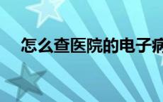 怎么查医院的电子病历 医院病历怎么开 