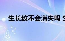 生长纹不会消失吗 生长纹会自己消失吗 