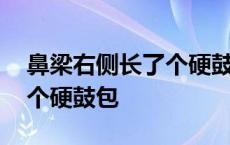 鼻梁右侧长了个硬鼓包像骨头 鼻梁右侧长了个硬鼓包 