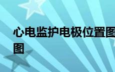 心电监护电极位置图图片 心电监护电极位置图 