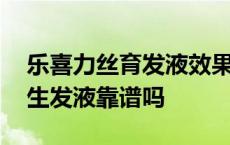 乐喜力丝育发液效果怎么样多少钱 乐喜力丝生发液靠谱吗 