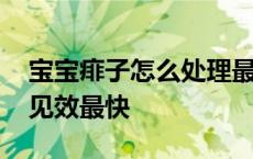 宝宝痱子怎么处理最好办法 宝宝痱子怎么治见效最快 