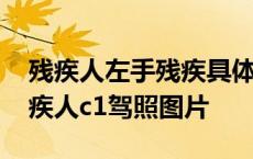 残疾人左手残疾具体啥样的能考驾照 左手残疾人c1驾照图片 