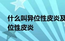 什么叫异位性皮炎及皮肤瘙痒症状 什么叫异位性皮炎 