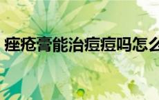 痤疮膏能治痘痘吗怎么用 痤疮膏能治痘痘吗 