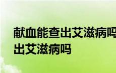 献血能查出艾滋病吗会告诉本人吗 献血能查出艾滋病吗 