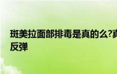 斑美拉面部排毒是真的么?真实效果揭秘 斑美拉面部排毒会反弹 