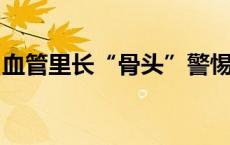 血管里长“骨头”警惕骨质疏松引发的冠心病