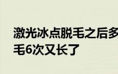 激光冰点脱毛之后多久可以洗澡 激光冰点脱毛6次又长了 