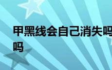 甲黑线会自己消失吗图片 甲黑线会自己消失吗 